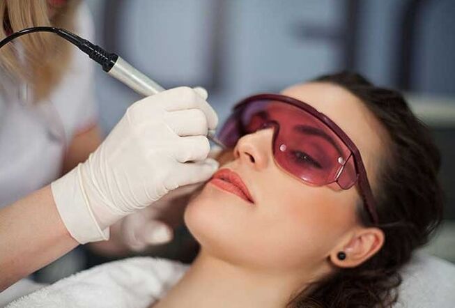 Biorevitalización láser