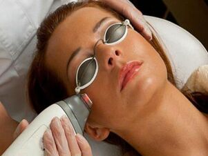 rejuvenecimiento facial con láser